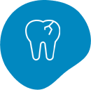 Cracked or Chipped Tooth