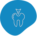 General Dentistry Dental Fillings