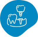 Dental Implants Brisbane Subperiosteal Implants