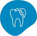 Cracked or Chipped Tooth