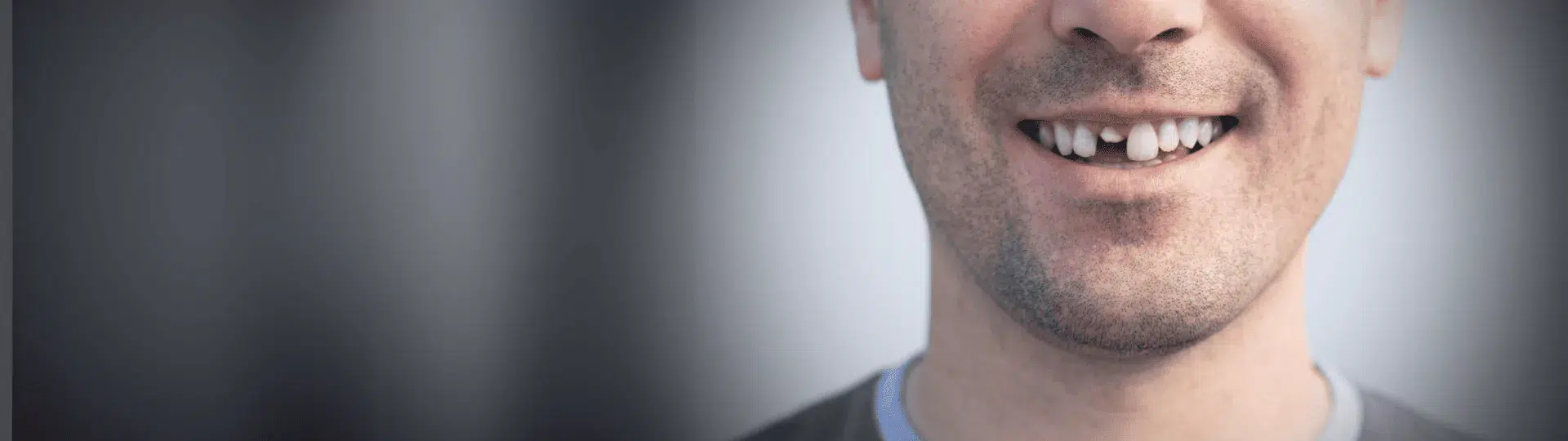 chipped-tooth