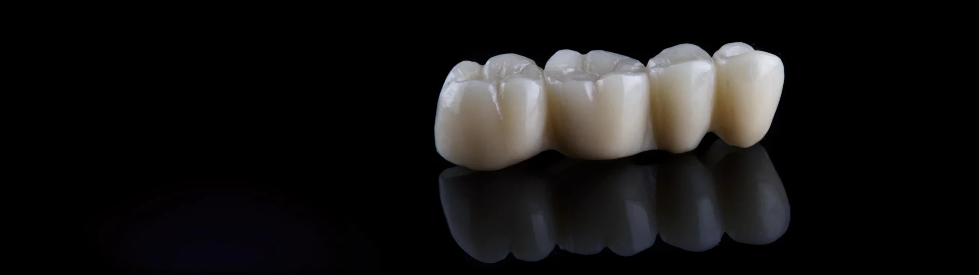 dental-crown