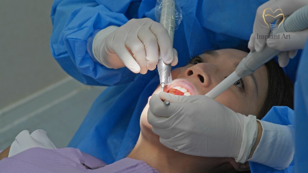 Single Dental Implant
