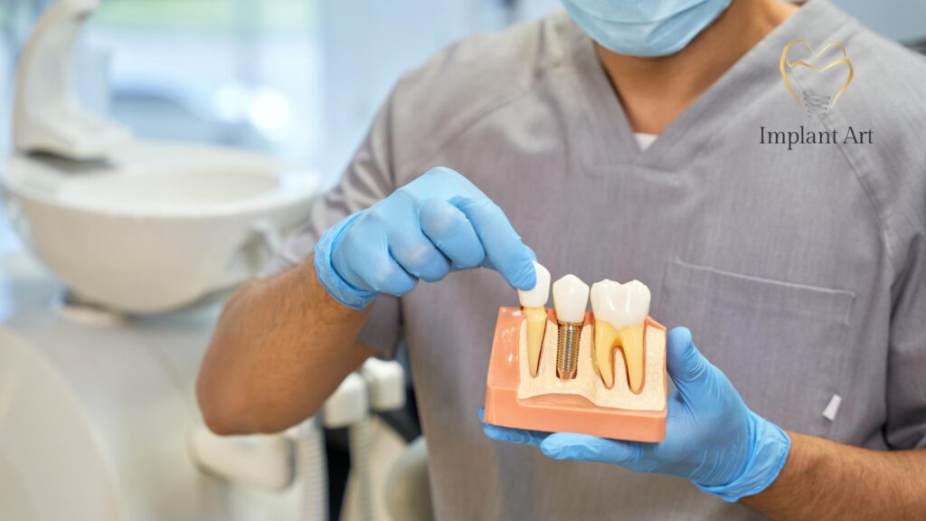 Bone Graft