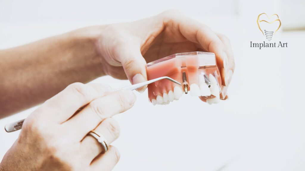 Dental Bone Graft