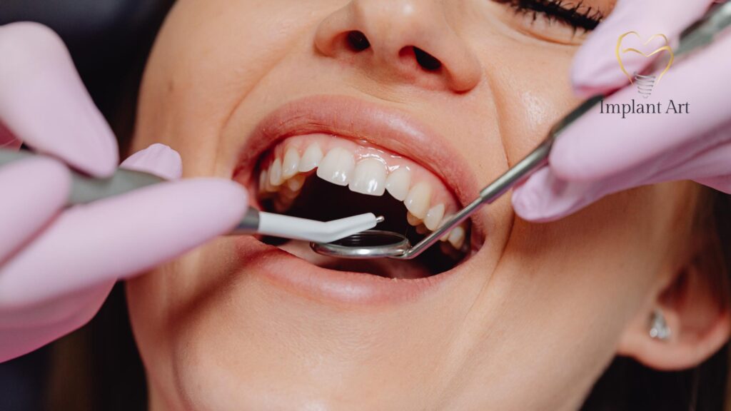 Bone Graft